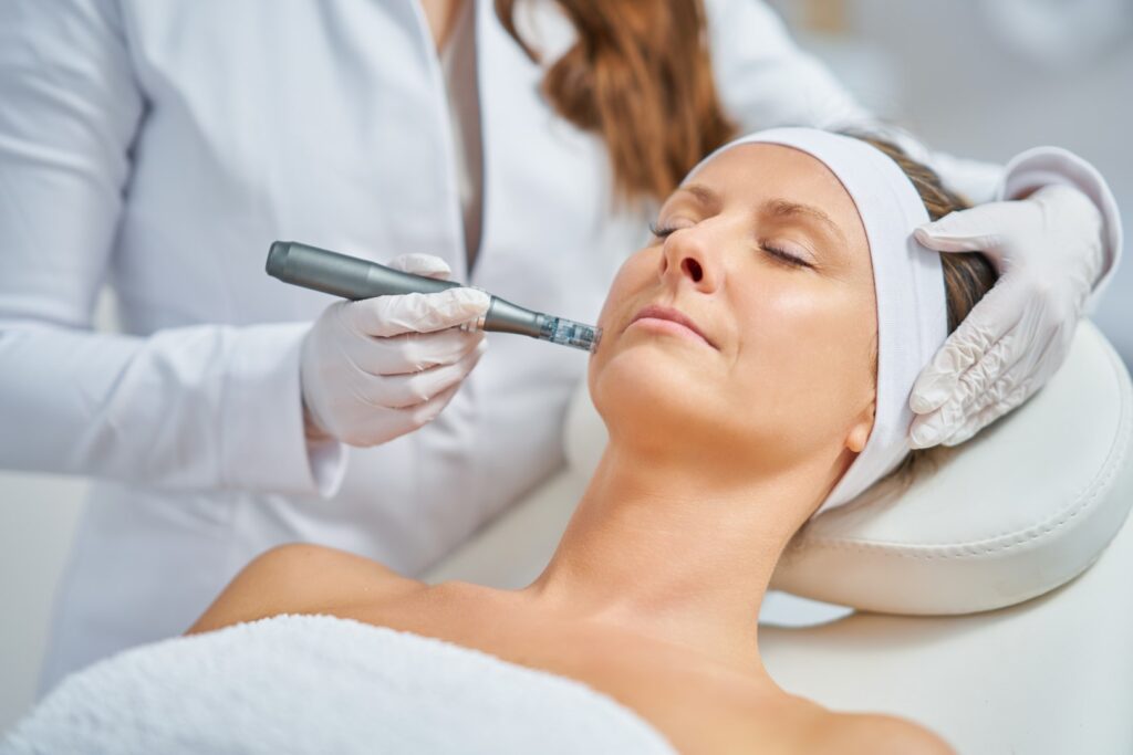 Microneedling Collagen Induction Therapy in Trenton MI
